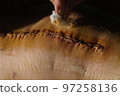 Surgical suture on the knee. Surgical wound sutured with special metal suture for healing. Total knee joint replacement. Close-up. 97258136