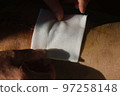 Surgical suture on the knee. Surgical wound sutured with special metal suture for healing. Total knee joint replacement. Close-up. 97258148