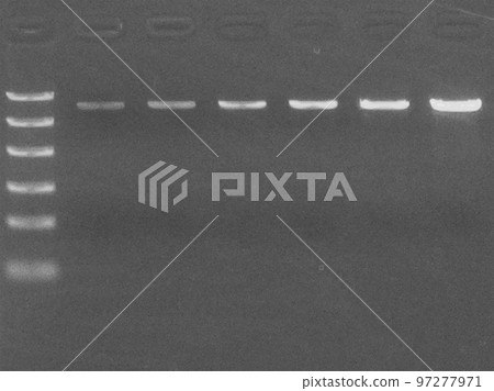 在瓊脂糖凝膠上定量 DNA 在瓊脂糖凝膠上定量 DNA 97277971
