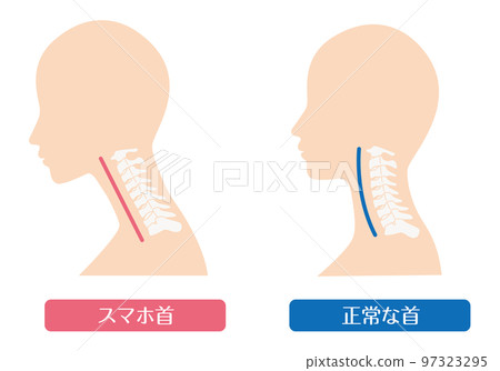 Smartphone neck straight neck Smartphone neck straight neck 97323295