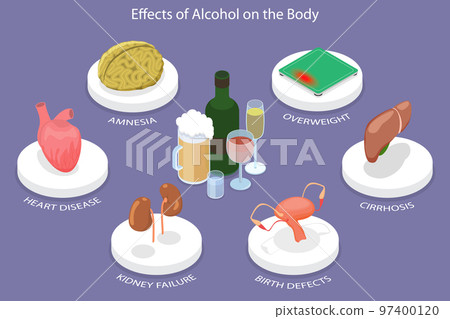 3D Isometric Flat Vector Conceptual Illustration of Effects Of Alcohol On The Body 97400120