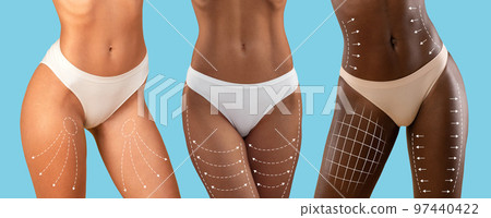 Millennial mixed race, european, black ladies in bikini with slim body with lines for figure shaping 97440422