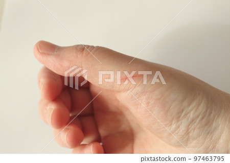 受傷的手指 受傷的手指 97463795