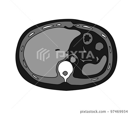 Multi-slice CT (abdomen) 97469934