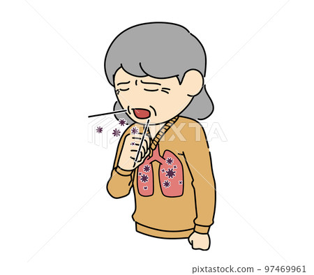 肺炎 肺炎 97469961