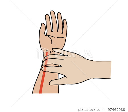 radial artery palpation 97469988