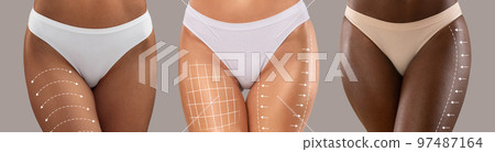 Millennial different women hips in bikini with perfect skin, slim body with lines for figure shaping or drainage massage Millennial different women hips in bikini with perfect skin, slim body with lines for figure shaping or drainage massage 97487164