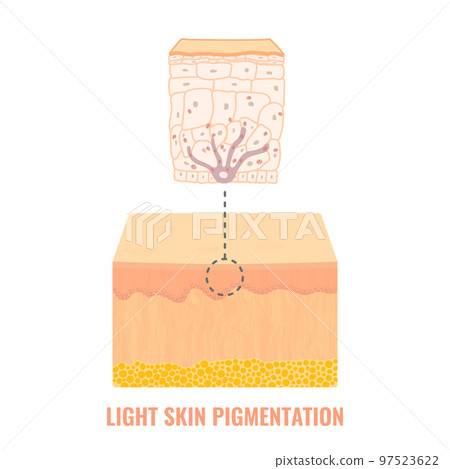 Light skin tone pigmentation mechanism medical diagram 97523622