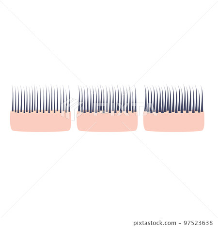 Hair thickness set on scalp skin cross-section icon 97523638