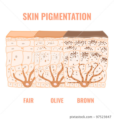 Human skin tone pigmentation diversity infographic diagram Human skin tone pigmentation diversity infographic diagram 97523647