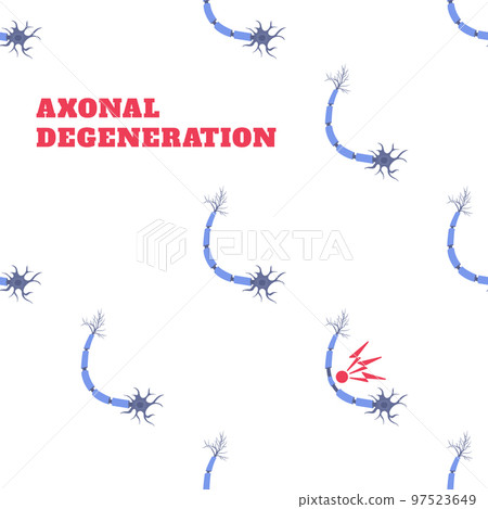 Axonal nerve degeneration disease awareness neuron pattern Axonal nerve degeneration disease awareness neuron pattern 97523649