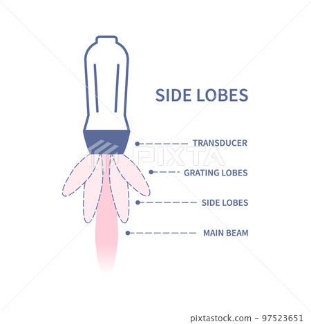 Ultrasound side lobe artifacts sonography diagram illustration 97523651
