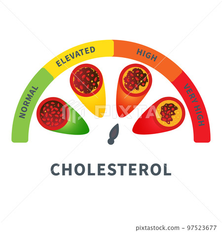 Cholesterol level meter gauge with blood vessel diagram 97523677