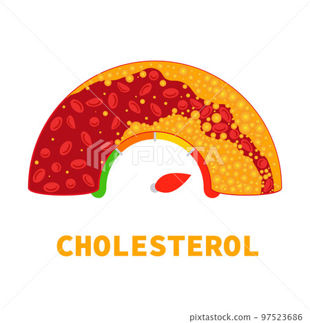 Cholesterol level meter gauge with blood vessel 97523686