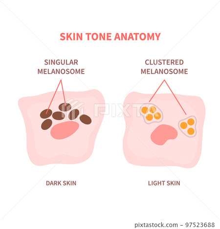 Melanosome distribution in dark and light skin 97523688