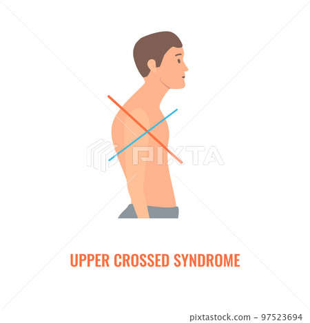 Crooked man with upper crossed syndrome imbalance Crooked man with upper crossed syndrome imbalance 97523694