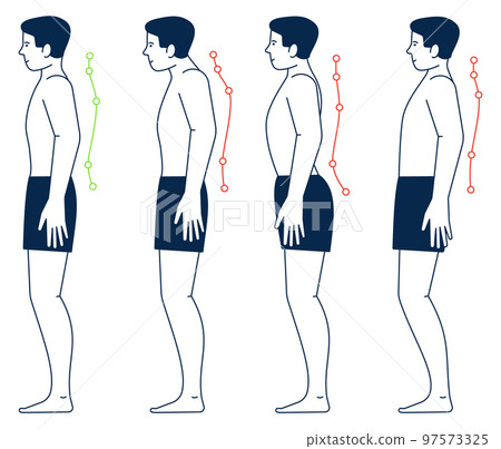 Male body with right and wrong spine postures. Body positions Male body with right and wrong spine postures. Body positions 97573325