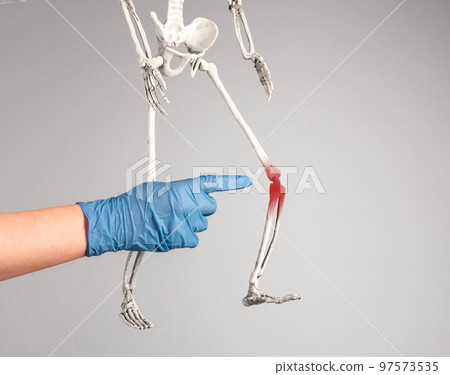 Doctor hand pointing to skeleton knee with red point. Leg pain. Sprained, ruptured ligaments, meniscus tear, tendinitis, arthritis. Skeletal system anatomy, medical education concept. 97573535