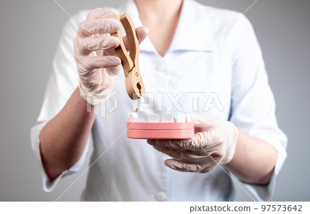 Dentist pulling tooth with forceps out of jaw model. Teeth extraction caused by trauma, decay, dental disease. Stomatology, health care concept. 97573642