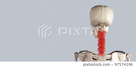 Banner with human skeleton cervical vertebrae with red point. Neck pain, stiffness. Inflammation, injury, poor posture, overuse consequences. Copy space Banner with human skeleton cervical vertebrae with red point. Neck pain, stiffness. Inflammation, injury, poor posture, overuse consequences. Copy space 97574196
