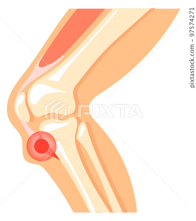 Knee pain icon. Leg anatomy with red spot Knee pain icon. Leg anatomy with red spot 97574271