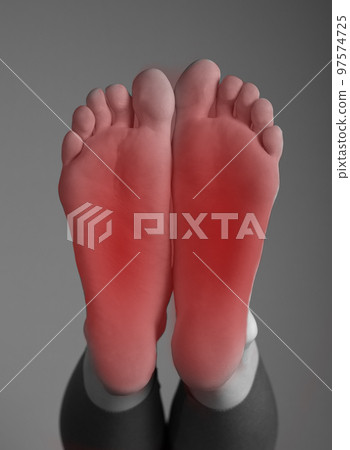 Foot pain. Woman feet with red point. Arthritis, gout, tendinitis, plantar fasciitis, injury, overuse, poorly fitting shoes consequences. Black and white 97574725