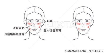 Aging sign diagram-3-blemish 97610312