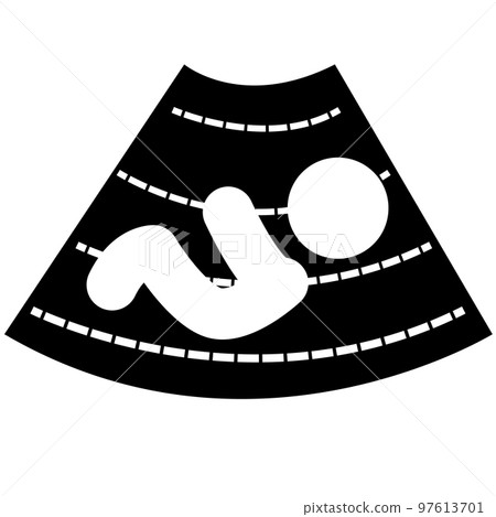 Ultrasonography baby icon on white background. Ultrasonography sign. flat style. Ultrasonography baby icon on white background. Ultrasonography sign. flat style. 97613701