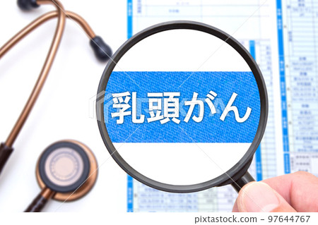 Papillary carcinoma (papillary thyroid cancer) Papillary carcinoma (papillary thyroid cancer) 97644767