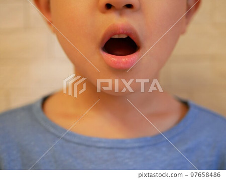 張大嘴巴的男孩 張大嘴巴的男孩 97658486