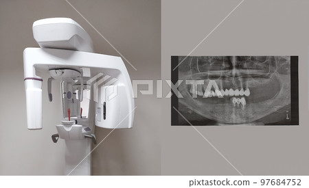Modern dental digital 3D tomograph. Dental cone beam tomograph, treatment and prevention of oral cavity 97684752