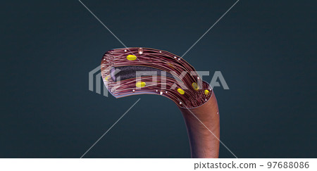 muscle that performs automatic tasks such as constricting blood vessels. muscle that performs automatic tasks such as constricting blood vessels. 97688086