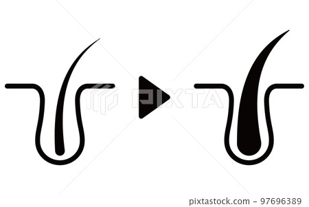 AGA(頭髮稀疏治療)治療圖像圖標,AGA 圖像 AGA(頭髮稀疏治療)治療圖像圖標,AGA 圖像 97696389