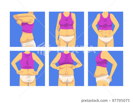 Female Torso with Sagging Belly and Soft Muscles Vector Set 97705075