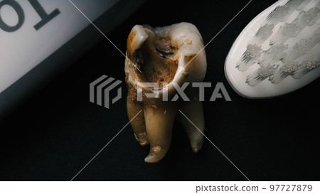 Tooth decay on black background. Macro shot of a decayed teeth till root after extraction of dentist. Real tooth anatomy due lack of care. Top view of caries teeth texture on black paper. Dental care. 97727879