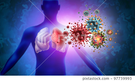 Triple Virus Lung Infection 97739993