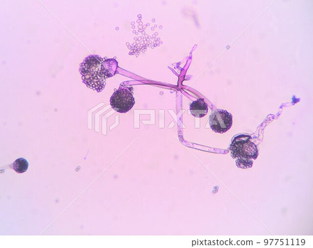 Root rhizomes of the genus Rhizopus zygomycetes Root rhizomes of the genus Rhizopus zygomycetes 97751119