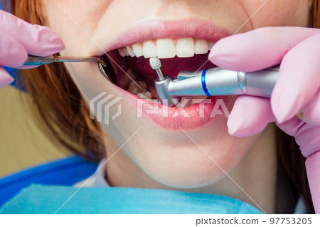 Dental drilling procedure and check up on beautiful teeth and open mouth 97753205