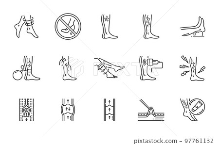 Varicose treatment icons, leg veins thrombosis disease and surgery vector symbols. Varicose or legs vascular varices circulation insufficiency, medical treatment and prophylactic therapy line icons Varicose treatment icons, leg veins thrombosis disease and surgery vector symbols. Varicose or legs vascular varices circulation insufficiency, medical treatment and prophylactic therapy line icons 97761132