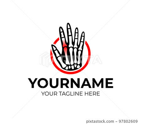 Hand with bones and a sore or inflamed joint in circle, logo design. Healthcare, medicine, rheumatology and traumatology, vector design and illustration Hand with bones and a sore or inflamed joint in circle, logo design. Healthcare, medicine, rheumatology and traumatology, vector design and illustration 97802609