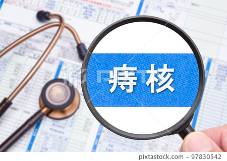 Hemorrhoid (warts hemorrhoids) 97830542