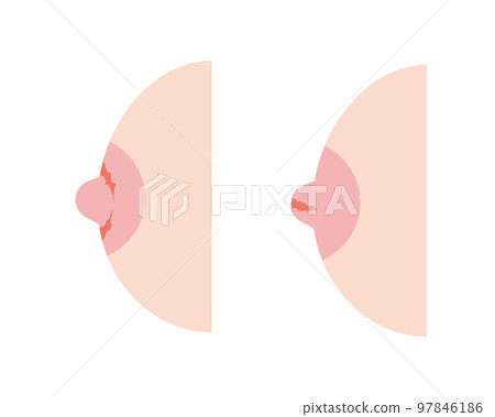 Female breasts with cracked nipples 97846186