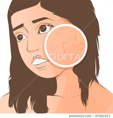 cartoon woman with skin dry and feel bad on white background. 97892922