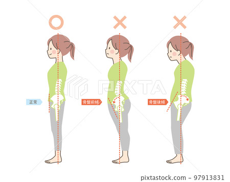 Sample of good and bad posture of women _ pelvis Sample of good and bad posture of women _ pelvis 97913831