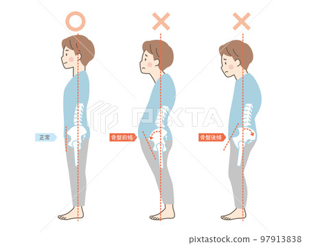 男人姿勢好壞樣本_骨盆 97913838