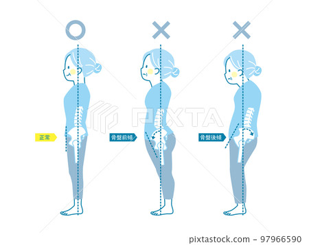 Sample of good and bad posture of senior women _ pelvis 97966590