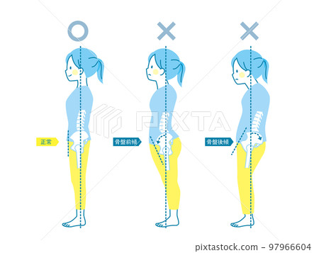 Sample of good and bad posture of women _ pelvis 97966604
