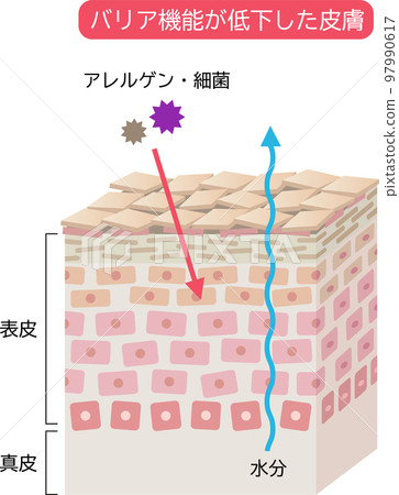 Skin with low barrier function Skin cells and cross-section 3D 97990617