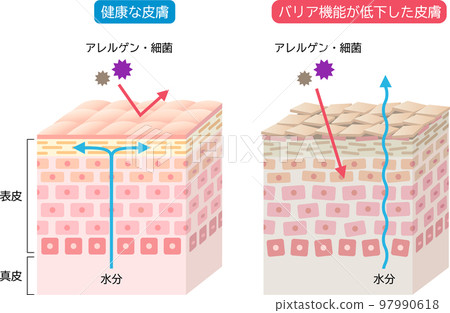 Dry skin and healthy skin with a well-developed barrier function Skin cells and a cross-sectional view 3D 97990618