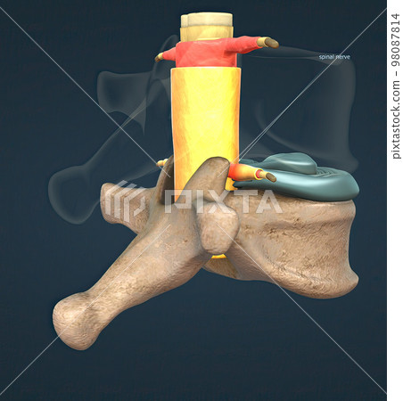 A slipped disc may also be called a prolapsed or herniated disc. 98087814